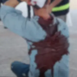 Briga em praça termina com homem ferido por garrafada