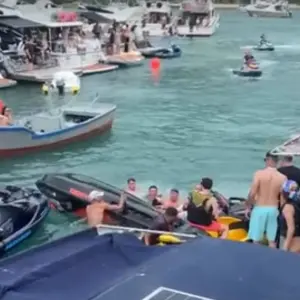 Mulher tem cabelo sugado por jetski e sofre ferimento no crânio