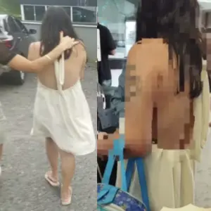 Mulher é presa por queimar mão de enteada de 2 anos