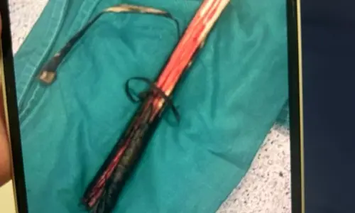 Homem tem pulmão perfurado por galho durante encontro de trilheiros