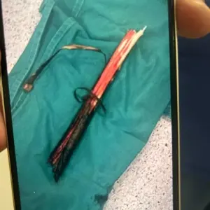 Homem tem pulmão perfurado por galho durante encontro de trilheiros